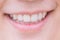 Closeup mouth good dental smile