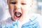 Closeup open mouth child and mirror in dentists hands in blue gloves checkup examine treating teeth to child, health