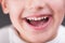 Closeup photo of boy mouth smiling