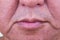 Closeup on saggy cheek skin of matured Asian man