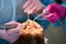 Closeup of a scaling and polishing procedure performed by two dentists in pink gloves to a male client