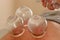 Closeup shot of three glass vases placed on skin during a massage session