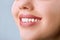 Closeup of smile with white healthy teeth.Teeth whitening. Dental care. Lips care.