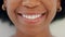 Closeup of smiling dentist showing white teeth with orthodontic invisible braces or a teeth whitening treatment and