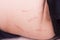 Closeup on stretch marks or cellulite on waist belly