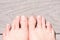 Closeup of ugly woman\'s feet