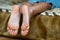 Closeup of woman feet sole with dry cracked skin. Foot and toes care concept