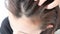 Closeup woman hand itchy scalp, Hair care concept