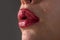 Closeup of woman healthy lips. Cosmetology injections. Beauty plastic. Lip augmentation.