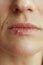 Closeup on woman with herpes on lips on beige background