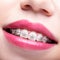 Closeup of woman open smiling mouth with brackets