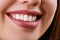 Closeup Woman smile. Teeth whitening. Dental care. Restoration concept. Lips.