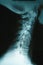 Closeup Xray of Human Neck