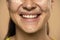Closeup of young smiling woman with concealer on her face on