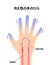 Cold hand blood circulation illustration sensitivity to cold, cold fingertips