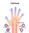 Cold hand blood circulation illustration sensitivity to cold, cold fingertips