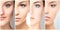 Collage of female portraits. Healthy faces of young women. Spa, face lifting, plastic surgery concept.