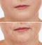 Collage with photos of mature woman having dry skin problem before and after moisturizing, closeup