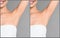 Collage of woman showing armpit before and after epilation on grey background, closeup