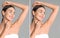 Collage of woman showing armpit before and after epilation on light grey background