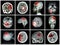 Collection of brain disease