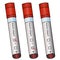 Collection of clinical samples. Test tubes with patient analyzes. Colored vector set. Isolated white background. Diagnosis.