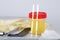 Collection cup with urine test on a table of a lab technician.