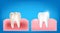 Collection of dirty tooth and gum compare with clean and strong