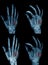 Collection hand x-ray image