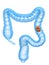 Colon cancer