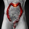 Colon / Large Intestine - Male anatomy of human organs - x-ray view