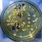 Colonies of pathogenic bacteria in a Petri dish, microbiological studies