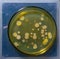 Colonies of pathogenic bacteria in a Petri dish, microbiological studies