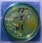 Colonies of pathogenic bacteria in a Petri dish, microbiological studies