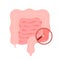 Colonoscopy intestine, polypectomy procedure, removal polyp in colon. Checkup gut, colon surgery. Operation intestine