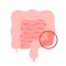 Colonoscopy intestine, polypectomy procedure, removal polyp in colon. Checkup gut, colon surgery. Operation intestine
