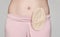 Colostomy pouch attached to patient - image