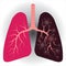 Compare between normal healthy lung and coronavirus lung damage vector illustration isolated