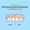 Compare upper teeth Recession gums treatment before