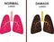 Compare vector illustration of normal and damaged lung damage isolated