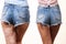 Comparison of legs with and without cellulite