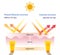Comparison of physical, mineral sunscreen and chemical sunscreen vector on white background.