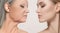 Comparison. Portrait of beautiful woman with problem and clean skin, aging and youth concept, beauty treatment