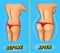 Comparison of skinny female buttocks and tightened after traininComparison of skinny female buttocks and tightened