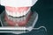 Complete denture or full denture.