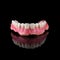 Complete maxillary denture â€“ Wax-Up and Gingival Contouring