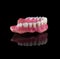 Complete maxillary denture â€“ Wax-Up and Gingival Contouring