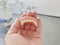 complete removable denture based on acrylic