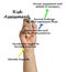 Components of Risk Assessment