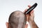 The concept of baldness and alopecia. A man holds a hair clipper and shaves the hair on top of his head. The view from the back.